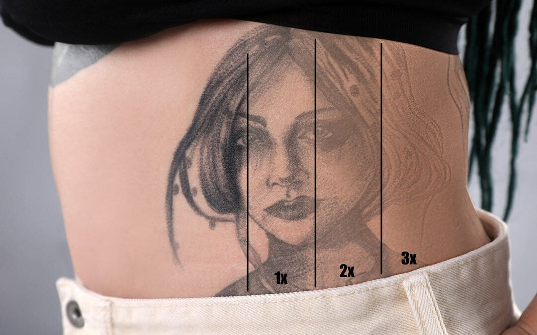 Common Tattoo Mistakes